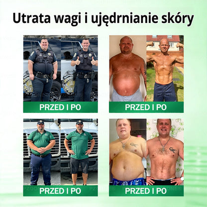 🇵🇱 Oficjalny sklep | 💯𝐏𝐙𝐆𝐎𝐍𝐄® Moringa·Berberyna×NAD+ 10-w-1 Plaster (Natychmiastowy efekt, widoczne rezultaty po 7 dniach) ✅ Stosowane w celu utraty wagi, poprawy zwiotczałej skóry, leczenia cukrzycy, bezdechu sennego i problemów ze stawami.