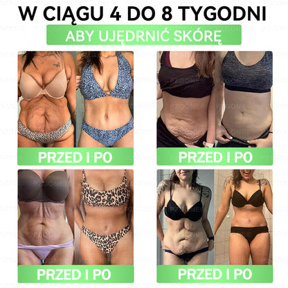 🔥𝐏𝐙𝐆𝐎𝐍𝐄® Superfood 𝑵𝒂𝒏𝒐 Mikronakłuwana Plaster🎁 Zostało tylko 10 pudełek! 🎁 Dajemy dodatkowe 40% zniżki! Dbaj o swoje zdrowie! Jeśli teraz przegapisz, w tym roku już nie będzie okazji!