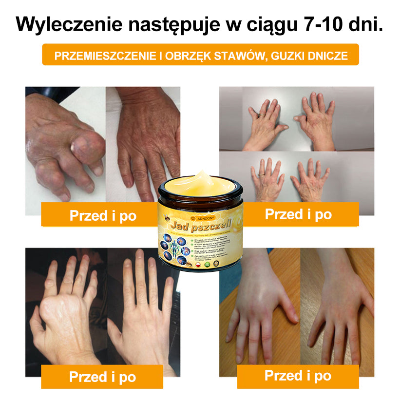 ⭐🎁 Zostało tylko 10 pudełek! 🎁 Dajemy dodatkowe 40% zniżki! Dbaj o swoje zdrowie! Jeśli teraz przegapisz, w tym roku już nie będzie okazji!