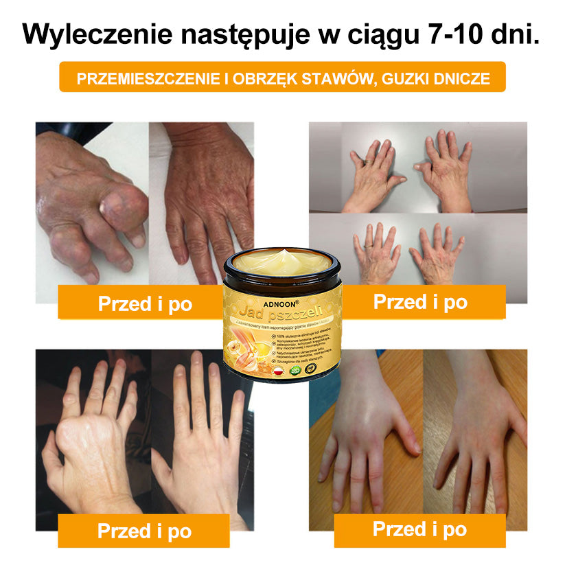 ⭐🎁 Zostało tylko 10 pudełek! 🎁 Dajemy dodatkowe 40% zniżki! Dbaj o swoje zdrowie! Jeśli teraz przegapisz, w tym roku już nie będzie okazji!