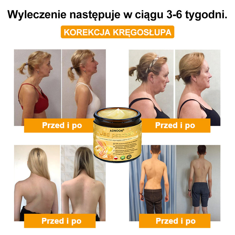 ⭐🎁 Zostało tylko 10 pudełek! 🎁 Dajemy dodatkowe 40% zniżki! Dbaj o swoje zdrowie! Jeśli teraz przegapisz, w tym roku już nie będzie okazji!