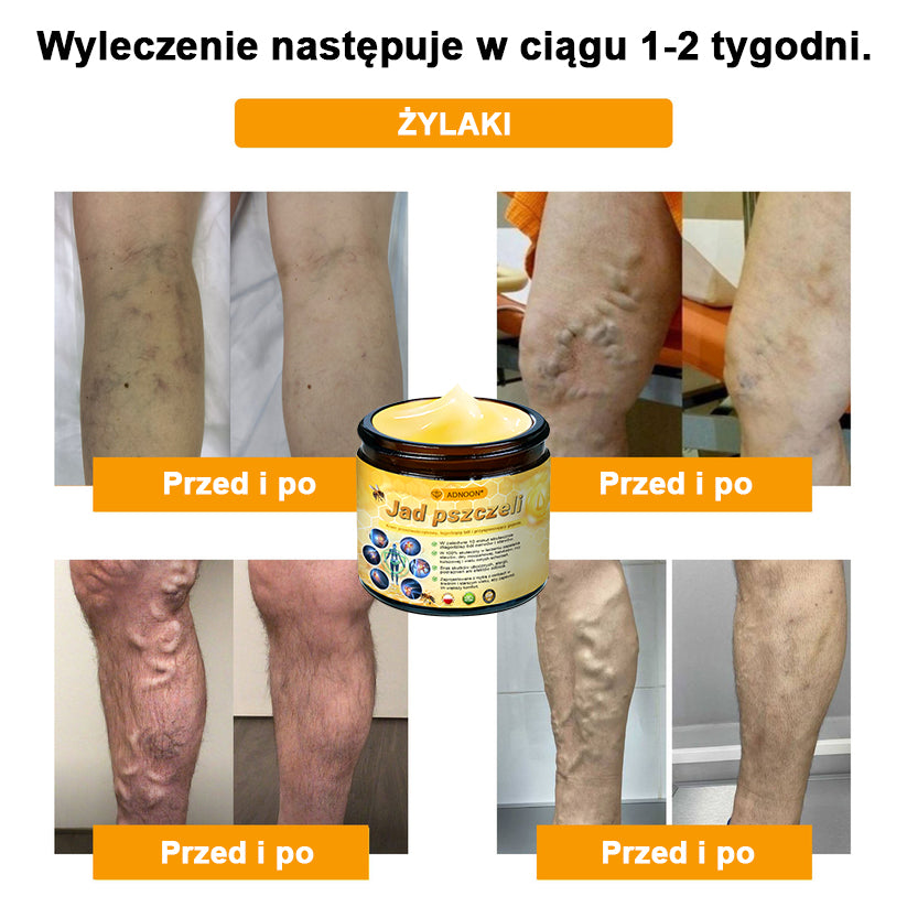 ⭐🎁 Zostało tylko 10 pudełek! 🎁 Dajemy dodatkowe 40% zniżki! Dbaj o swoje zdrowie! Jeśli teraz przegapisz, w tym roku już nie będzie okazji!